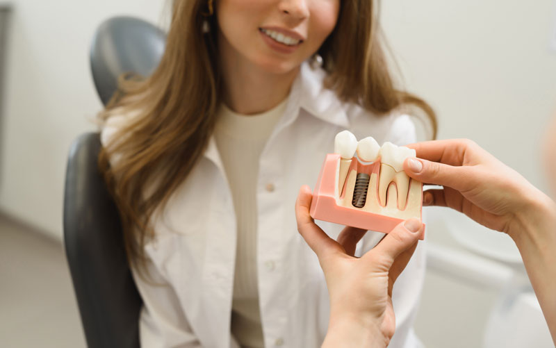 A dentist explains a dental implant model to a patient, showcasing the implant post and crown. The professional setting highlights patient education and advanced dental care.